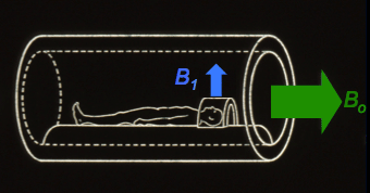 MRI RF coil B1, B0